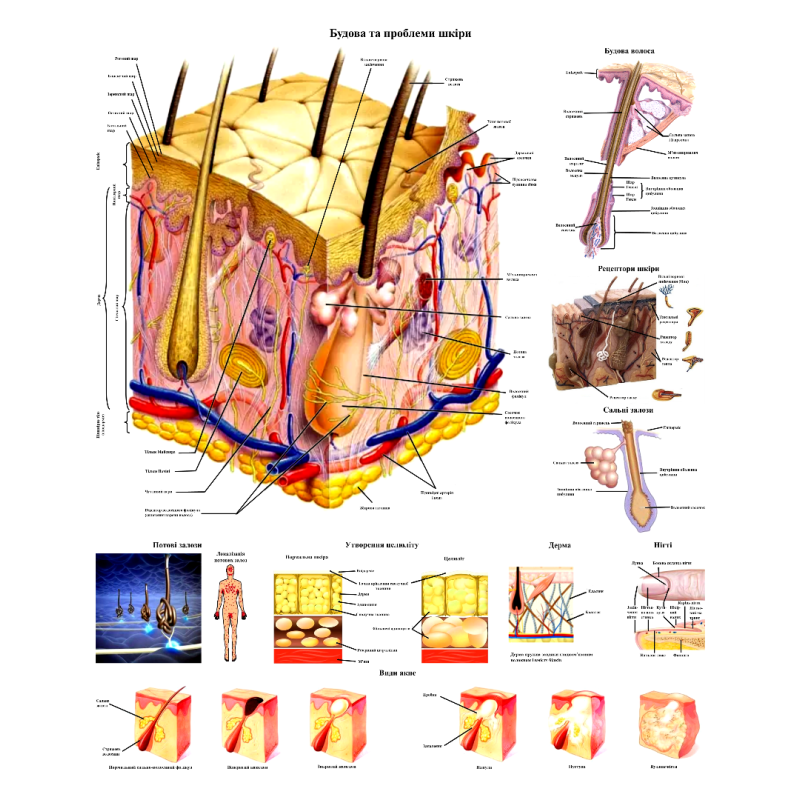Анатомічний плакат Будова та проблеми шкіри 86×67 см Медичний плакат Плакати для дерматологів