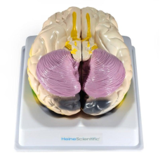 Модель мозку з функціональними полями