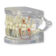 Прозора модель щелепи