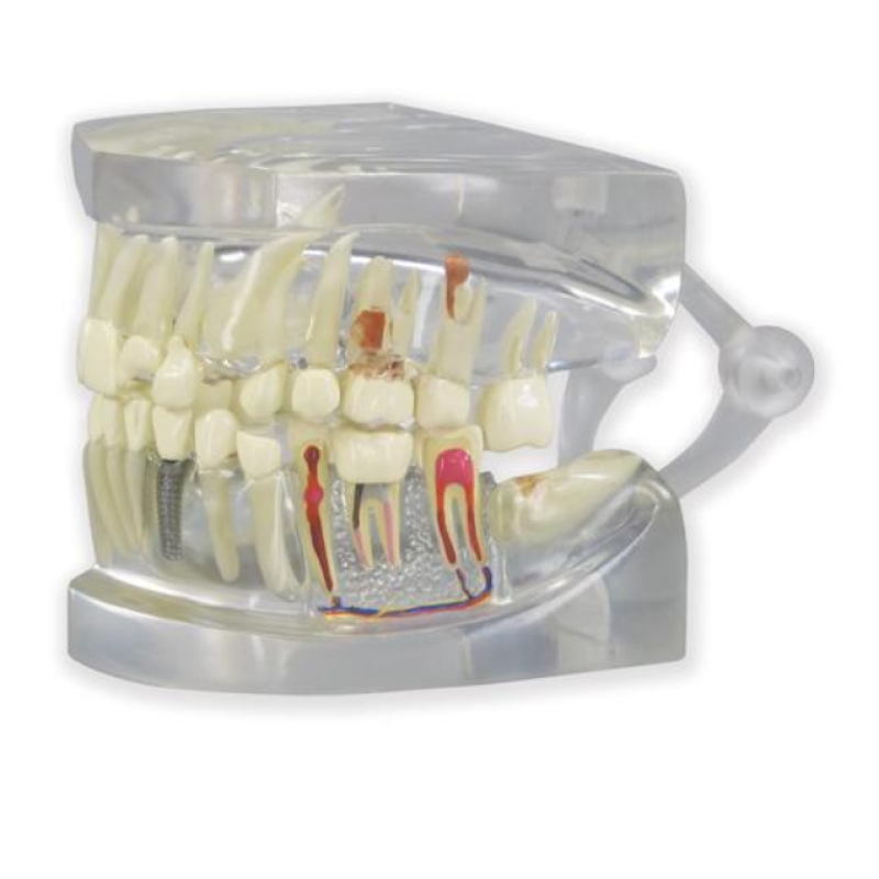 Прозора модель щелепи Прозора модель щелепи