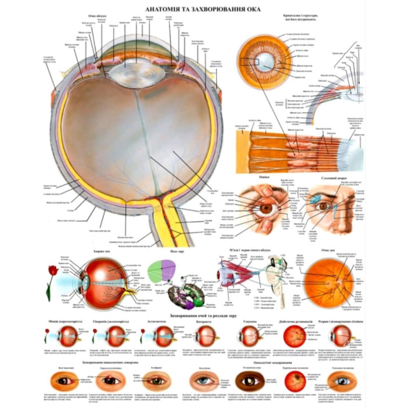 Плакат Анатомія та захворювання ока 67*86 см Деталізований плакат Плакат для вищих навчальних закладів Плакат Анатомія та захворювання ока 67*86 см Деталізований плакат Плакат для вищих навчальних закладів