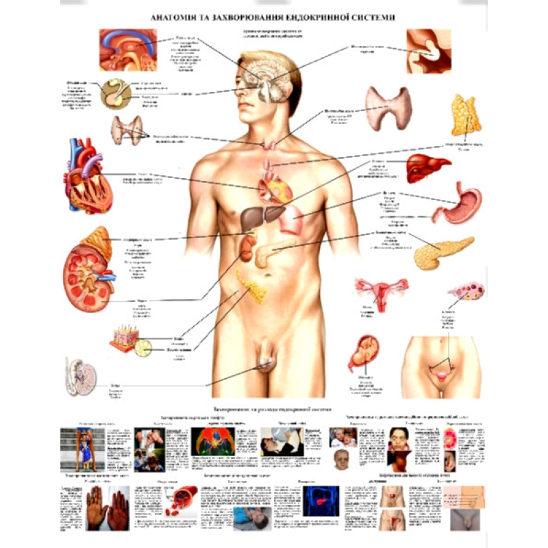 Плакат ,,Анатомія та захворювання ендокринної системи“. 50x64.5 см