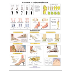 Плакат анатомії і деформації стопи 50×64.5см.