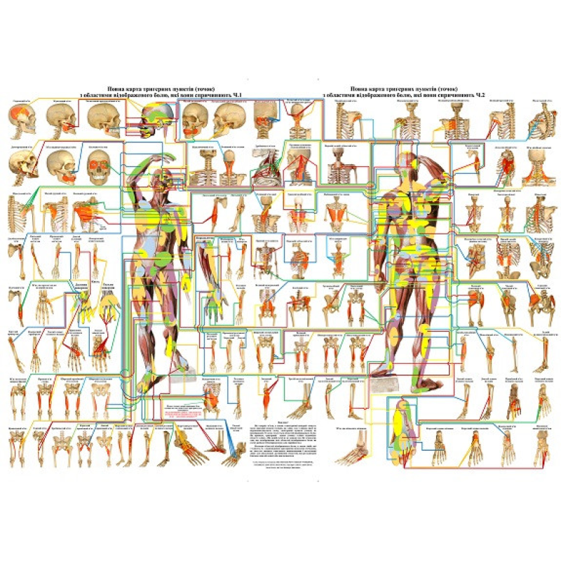 Плакат Повна карта тригерних пунктів (точок) з областями відображеного болю 119*86 см Плакат